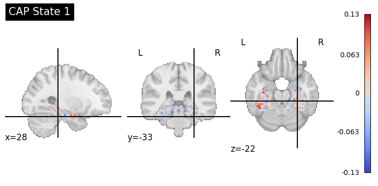 ../../_images/sections_notebooks_example_dfc_state3_7_0.png